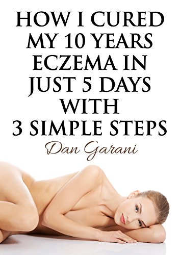 How I Cured My 10 Years Eczema In Just 5 Days With 3 Simple Steps, Skin care, eczema cure, get rid of eczema forever, easy and natural, eczema treatment, eczema remedies, stop eczema forever