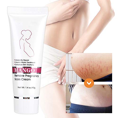 Stretch Mark Cream, Scar Cream Removal Cream Scars Acne Cream Pregnancy Treatment Maternity Repair