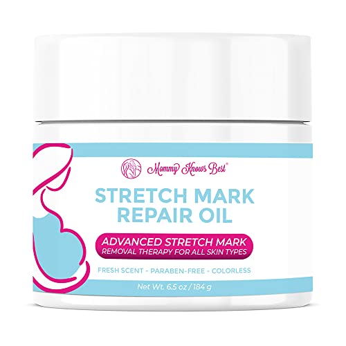 Stretch Mark Oil Cream for Pregnancy & Scar Removal Cream by Mommy Knows Best – Stretch Mark Remover Cream & Scar Cream – Shea & Cocoa Butter Stretch Mark Cream Remover for Maternity Skin Care