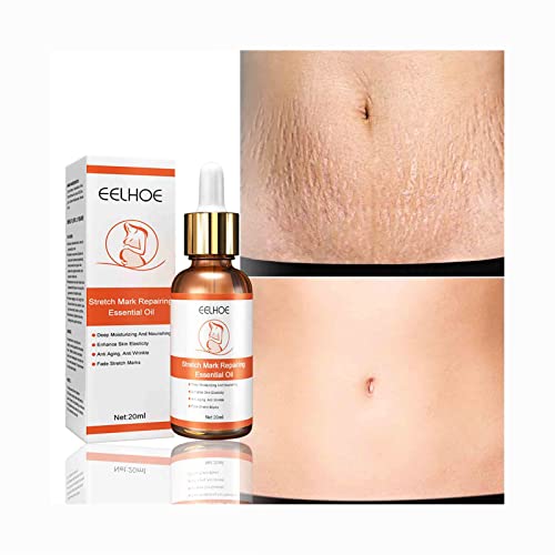 20ML Stretch Mark Repairing Essential Oil Scar Removal Cream Serum Improve Stubborn Lines Wrinkles Firming Lifting Loose Repair Moisturized Treatment Cream for Pregnant Woman Youthful Skin