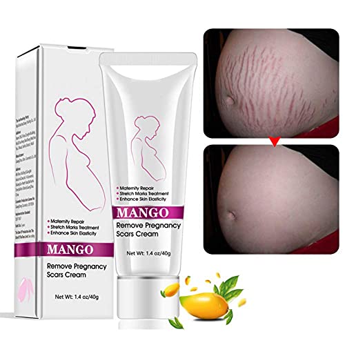 Stretch Mark Cream For Pregnancy Repair Scar Slack Line Abdomen Stretch Marks Cream, Remove Stretch Marks From Pregnancy, Repair Scar Slack Line Abdomen Stretch Marks Postpartum