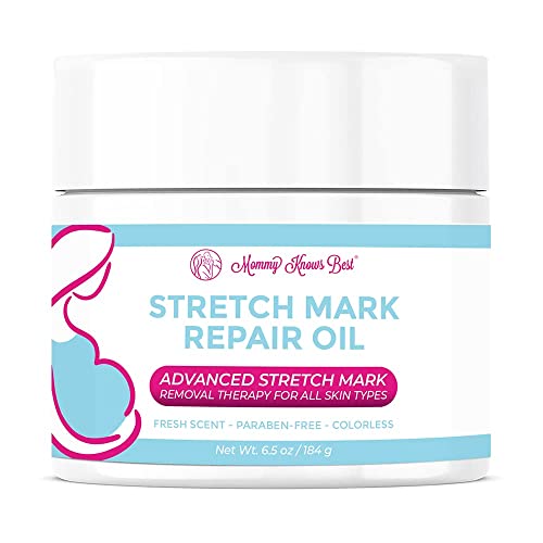 Stretch Mark Cream For Pregnancy (4oz)- Belly Cream For Pregnancy And Stretch Marks, Mommy Knows Best Stretch Mark Cream For Maternity Skin Care with Shea Butter Vitamin E (Oil)