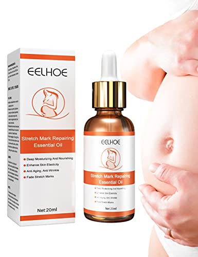 20ML Stretch Mark Repairing Essential Oil,Prevention & Remover of Maternity & Pregnancy Skin Care Cream Serum,Postpartum Scar Obesity Loose Repair Moisturized Pregnancy Epairing Cream (1box)